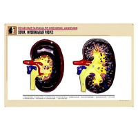 Рельефная таблица "Почка. Фронтальный разрез" (формат А1, матовое ламинир.) - «globural.ru» - Серов